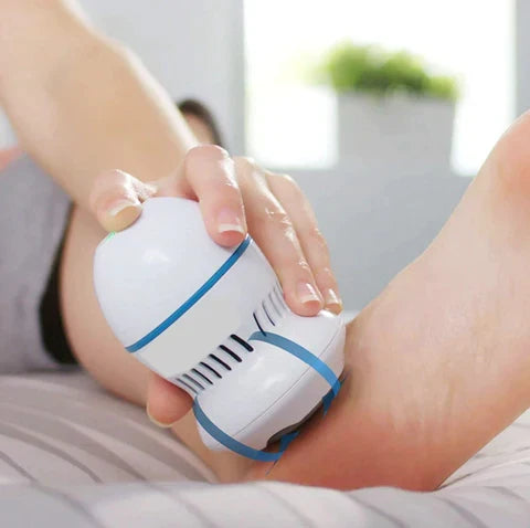 Radiant Bloom Vacuum Callus Remover