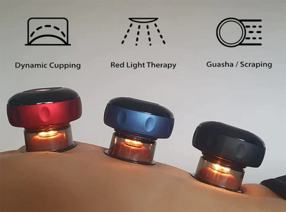 Radiant Bloom SmartCup